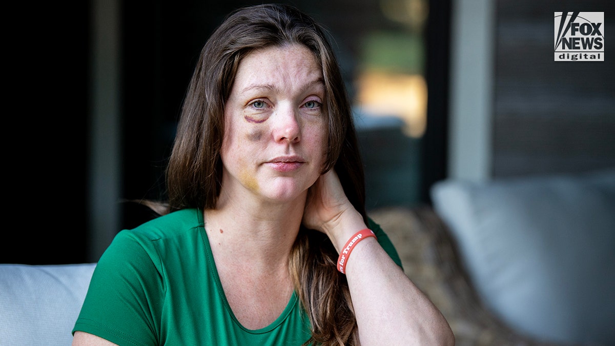 Cincinnati Brawl victime Holly pose pour une photo