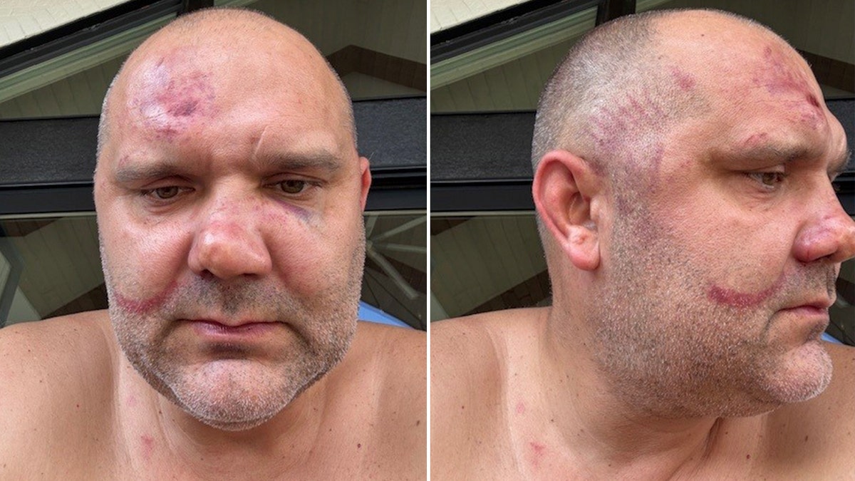 La victime d'agression de Cincinnati Alex Tchervinski